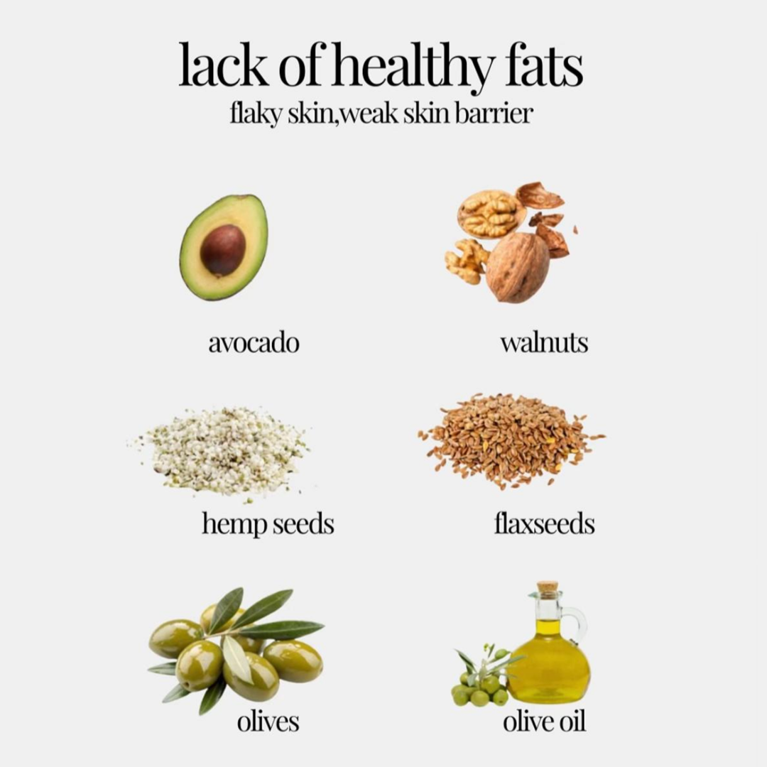 Quick Snack Ideas inspiration 43