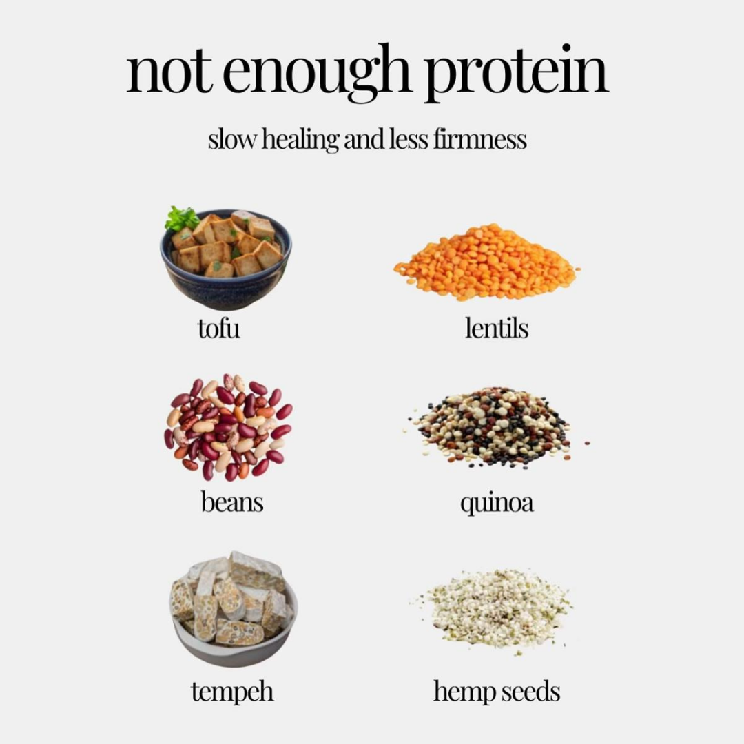 Quick Snack Ideas inspiration 43